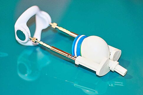 Extensor un dispositivo para un aumento efectivo en un miembro